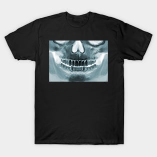 Killer Masks - Skull X-Ray T-Shirt